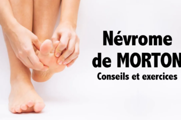 Le névrome de Morton, qu’est-ce que c’est ?